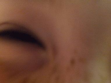 zach's eye